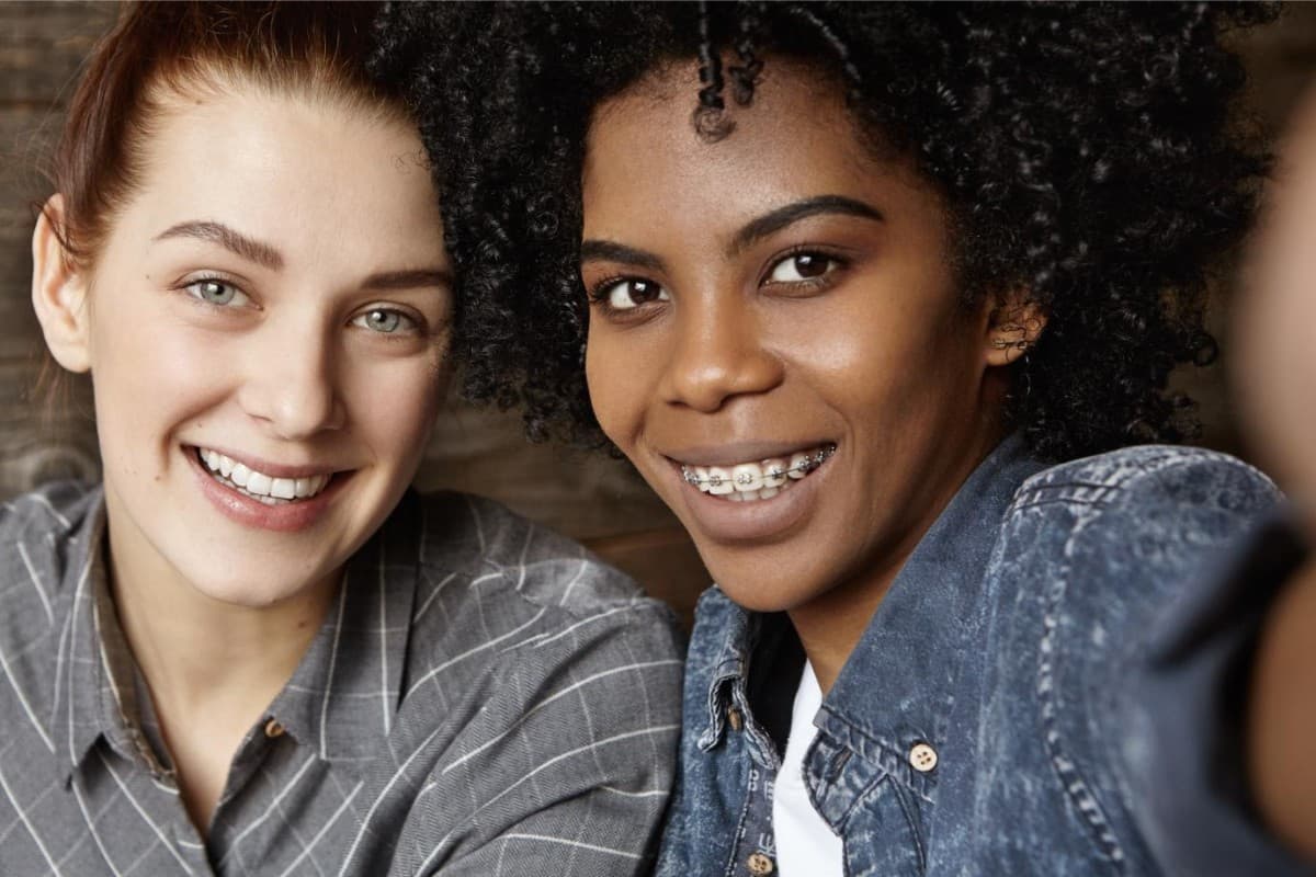 Seacoast Braces / Miller Orthodontics Exclusively Offers Dynaflex Norris Passive Self-Ligating Brackets in Dover and Exeter, NH